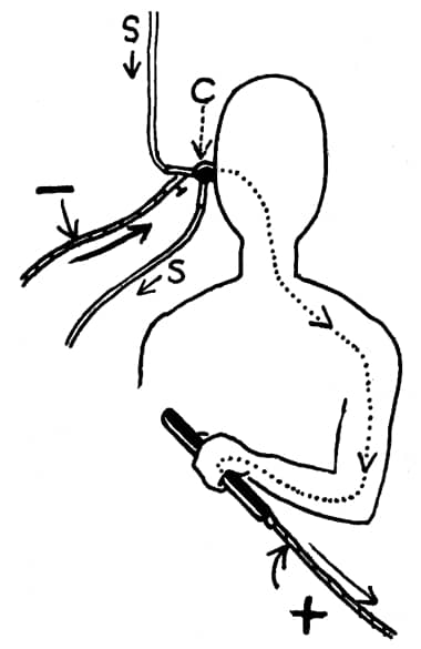 1946 Diagram showing the operation of the electrolytic cup