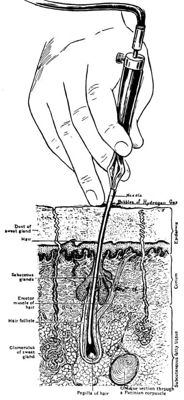 Electrolysis