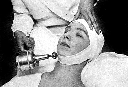 1929 Vibrator used over a chin strap